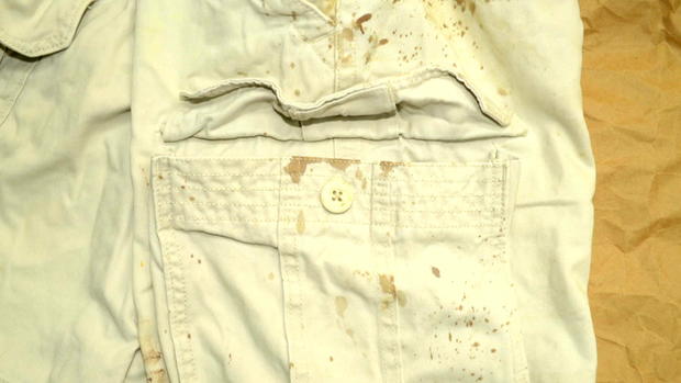 Dustin Parra's blood-spattered shorts. 