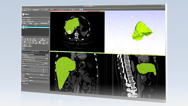 medical image segmentation tutorial