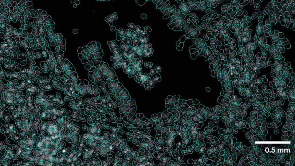 Live cell image showing cell segmentations.