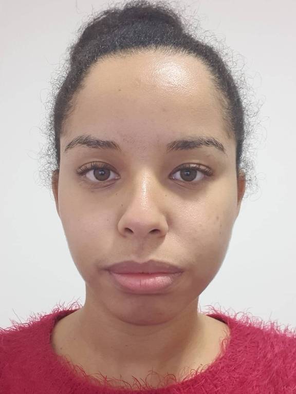 Filtro de modificação facial alonga rosto e altera a proporção dos traços, deslocando o nariz e a boca. Na foto com o efeito aplicado, apenas testa e gola da blusa ficam alinhados