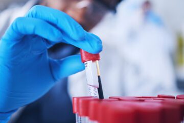 new blood test to detect colon cancer