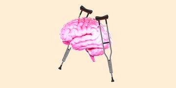 brain on crutches