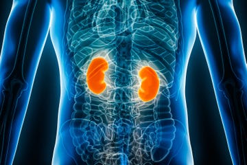 x ray kidneys