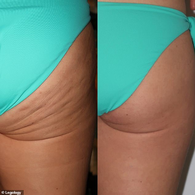 Before and after: Shoppers concerned with the appearance of cellulite on their legs and bum are seeing visible results in a matter of weeks thanks to the Cellu-Lite Oil