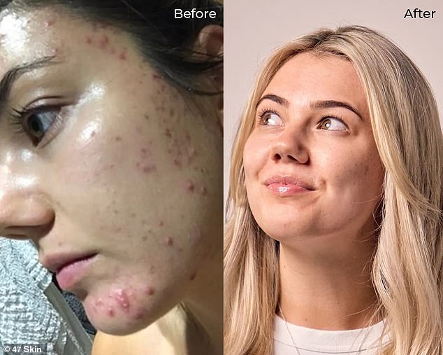 Hundreds of users rated the 47 Skin mask a perfect five-star rating and have reported it 'really works' on their congested complexions and 'makes a real difference'