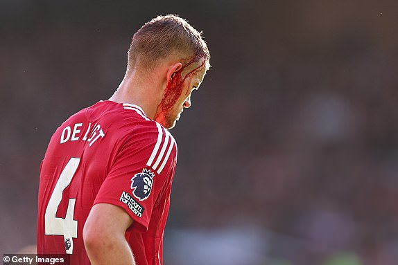 MANCHESTER, ENGLAND - OCTOBER 19: Matthijs de Ligt of Manchester United with a blooded head during the Premier League match between Manchester United FC and Brentford FC at Old Trafford on October 19, 2024 in Manchester, England. (Photo by Robbie Jay Barratt - AMA/Getty Images)