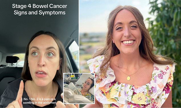 I was diagnosed with stage 4 bowel cancer at 25 - here's the unusual symptom that ALL