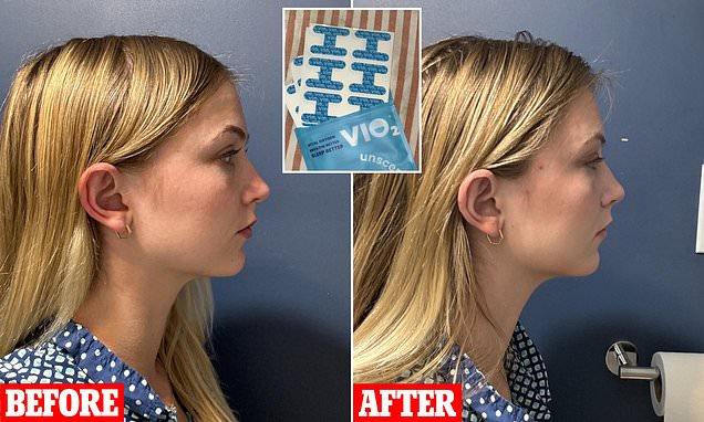 I tried the viral mouth taping trend to achieve better sleep, but was it worth the