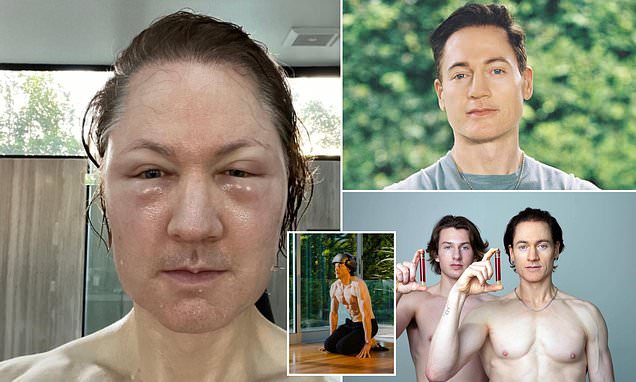 Anti-ageing 'guru' Bryan Johnson shares shocking selfie showing how his latest attempt to