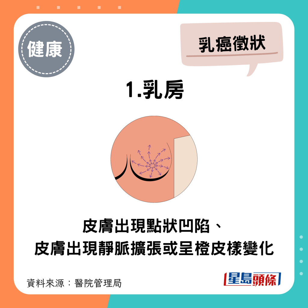 乳癌症狀 乳房：皮膚出現點狀凹陷、皮膚出現靜脈擴張或呈橙皮樣變化