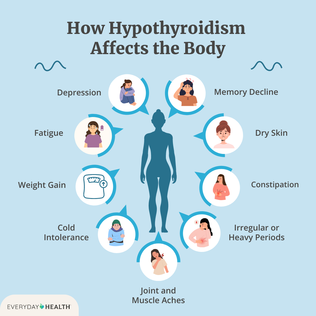 What Is Hypothyroidism? Symptoms, Causes, Diagnosis, Treatment, and Prevention