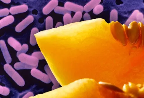 Photo of Listeria.