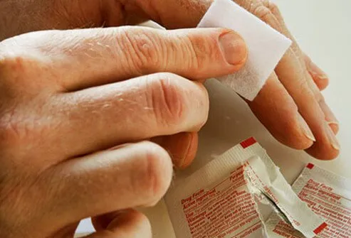 A man using antiseptic wipes to clean a wound on his finger.