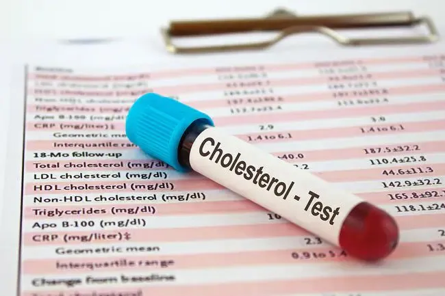 Shrimp do have some cholesterol, but experts believe blood cholesterol levels are not linked to dietary cholesterol.