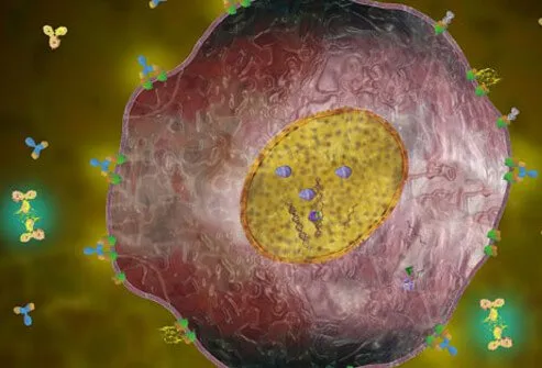 Having this receptor means the cancer tends to grow and spread faster than other forms of breast cancer.