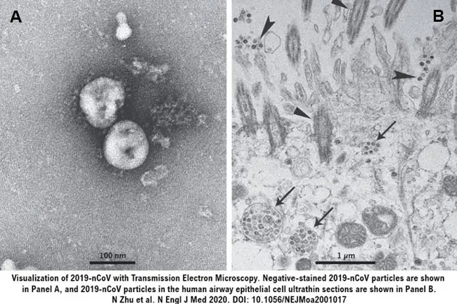 This is a class of virus that is known to mutate easily.