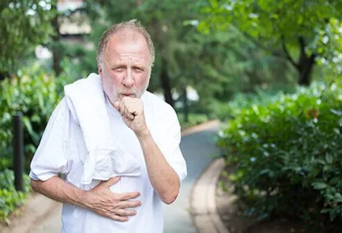 The main symptom of costochondritis is chest pain that varies in intensity.