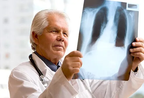 The diagnosis of costochondritis is based upon the patient's history and physical exam. 