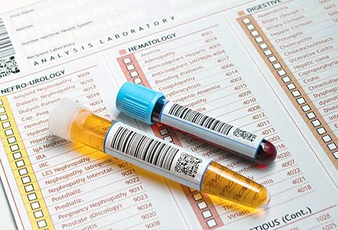 Blood and urine tests can check blood sugar and triglyceride levels. 