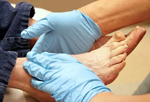 People who have diabetes should see a foot doctor (podiatrist) every 2 to 3 months, even when not experiencing foot problems.