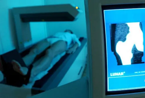 Learn your bone mineral density with a DXA scan.