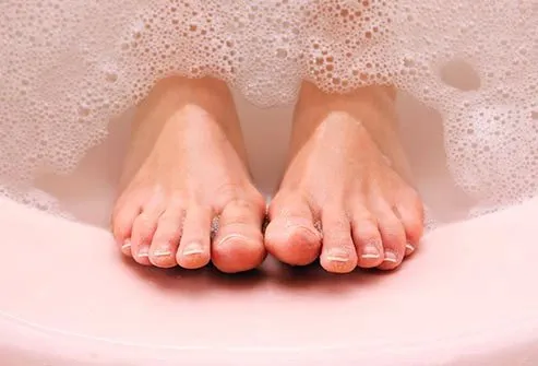 Warm baths help soothe the pain from genital herpes blisters. 