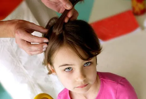 Head lice should not be considered a health hazard and do not spread disease.