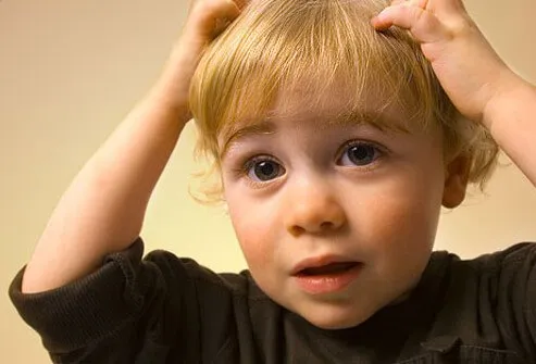 Although itching may be a sign of a lice infestation, most often individuals are asymptomatic.