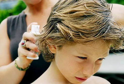 Most topical lice treatments are available without a prescription; however, since some of the ingredients may not be recommended for small children, always discuss the options with a health-care professional.