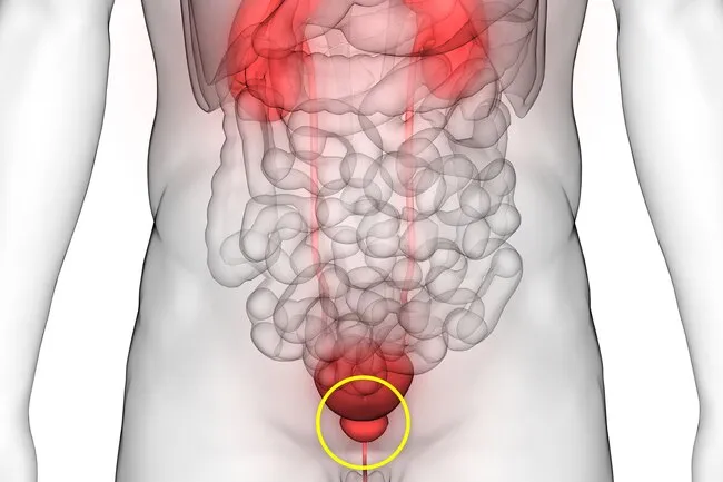 Soy consumption may reduce the risk of prostate cancer. 