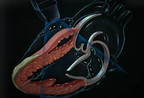 Another test option is echocardiography, which uses sound waves to generate images of the heart.