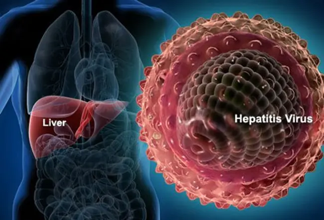 Inflammation of the liver of any cause is referred to as hepatitis.