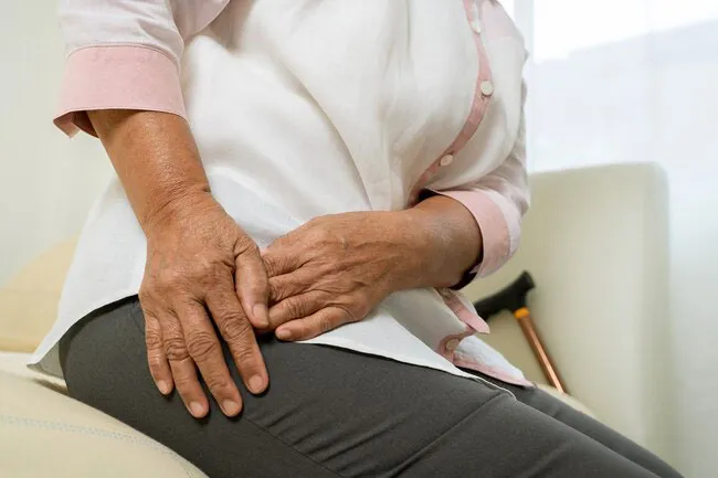 Arthritis pain is the most common reason to need hip replacement.