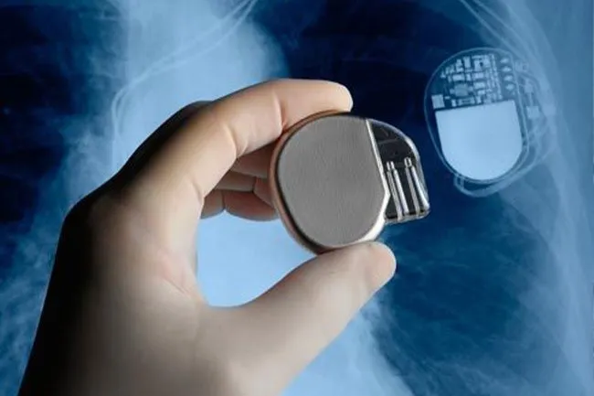 A pacemaker may help keep your heart beat steady. 