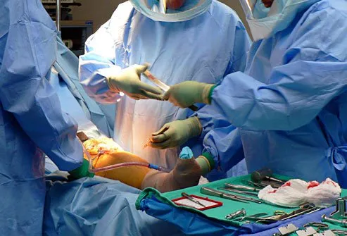 Knee replacement is safe for most people, but all surgery has risks.