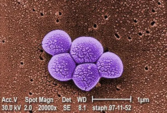 Strains of these bacteria (commonly termed staph) may cause infection in almost any part or organ system in humans.