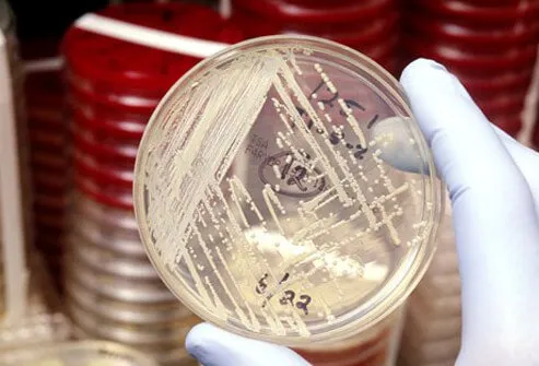 A petri dish with Staphylococcus aureus.