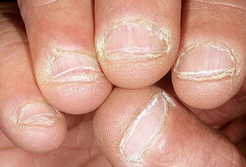 Chewing your nails leaves them looking raw and rough. 