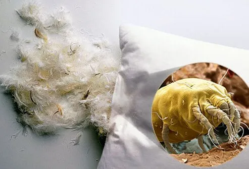 You can avoid some allergy attacks if you keep dust mites out of your mattresses and pillows.