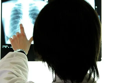 A doctor examines an X-ray.