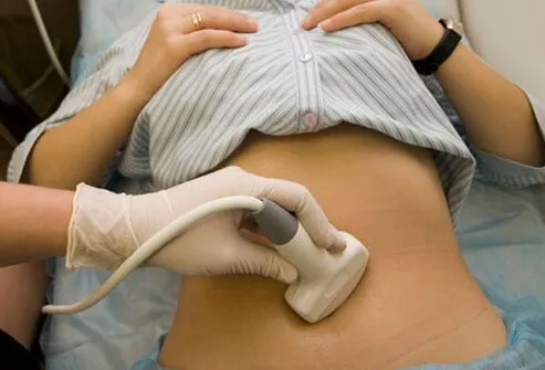 A woman having a sonogram diagnostic performed.