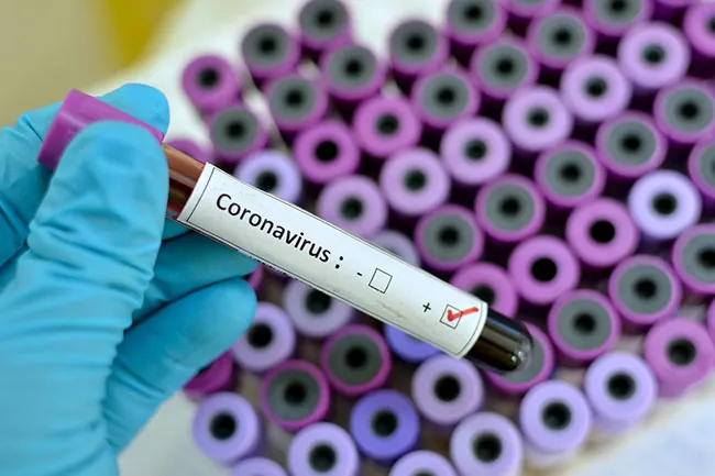 A coronavirus is a kind of common virus that causes an infection in your nose, sinuses, or upper throat.