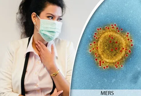 This viral infection was first reported in Saudi Arabia in 2012.