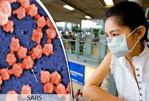 The SARS virus outbreak began in China in 2003 and spread worldwide, infecting over 8,000 people before it was contained.