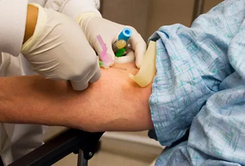 Blood tests are usually run to help make a diagnosis of rheumatoid arthritis.