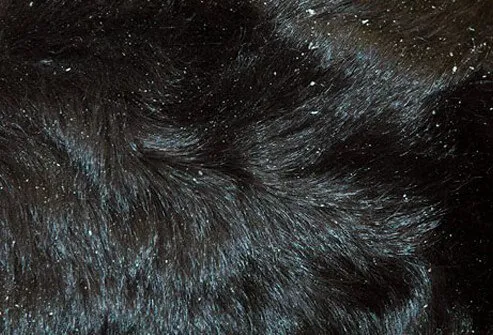 Skin flakes in dog's coat