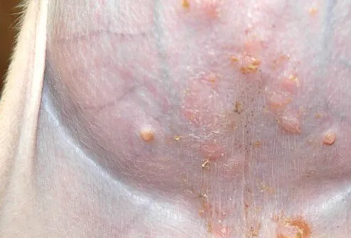 Dog's belly afflicted with impetigo