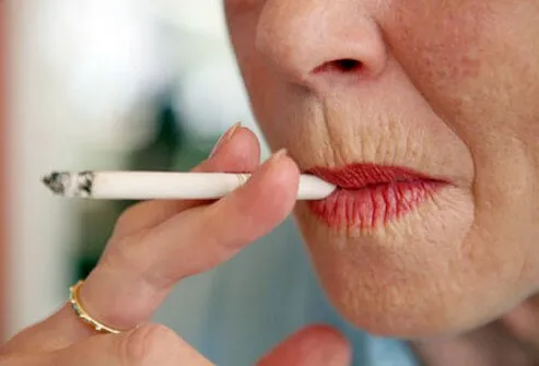 The damage to elastin in the skin is just one way that cigarette smoke affects the skin around the mouth. 