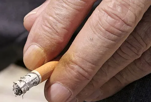 Tobacco stains the skin of the nails and hands. This can be a telltale sign of a chronic smoker.