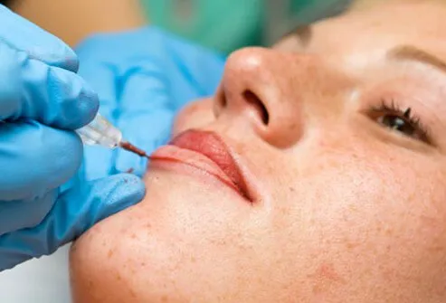 Woman Receiving Cosmetic Lip Tattoo